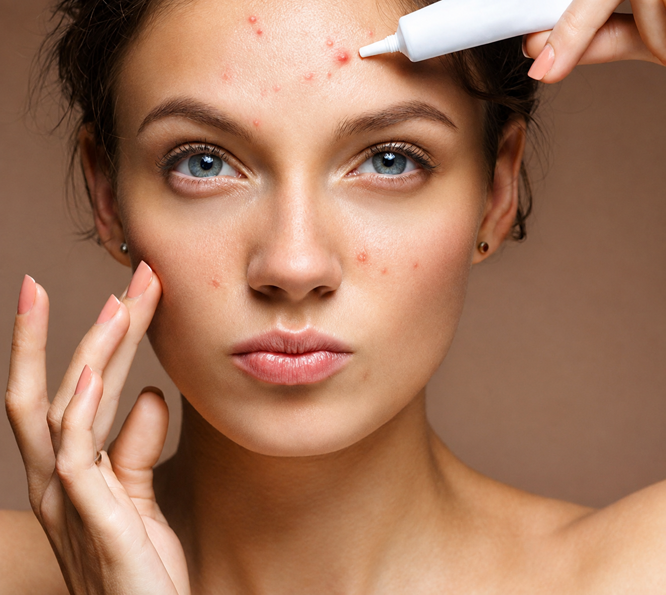 Acne & Oil Control